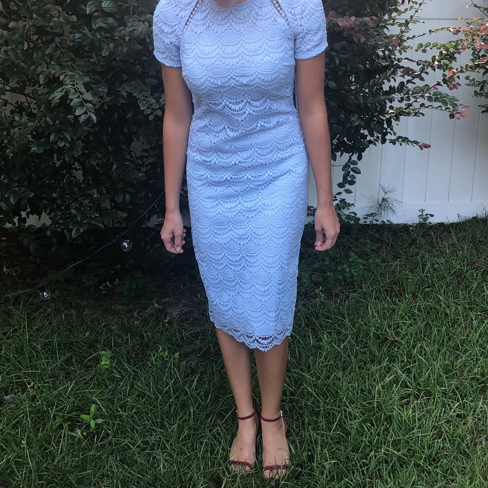 NEW tags attached! Light blue lace dress size 2